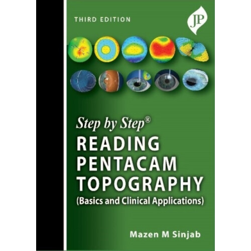Step by Step Reading Pentacam Topography Basics and Clinical Applicati