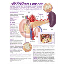 Understanding Pancreatic Cancer Anatomical Chart Paperback Book