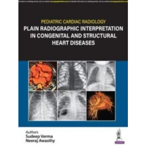 Pediatric Cardiac Radiology Plain Radiographic Interpretation in Conge