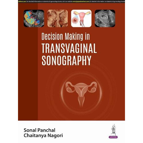 Decision Making in Transvaginal Sonography by Sonal Panchal Paperback