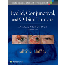 Eyelid Conjunctival and Orbital Tumors An Atlas and Textbook by Jerry