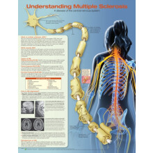 Understanding Multiple Sclerosis Anatomical Chart Paperback Book