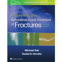 Hoppenfelds Treatment and Rehabilitation of Fractures Paperback Book