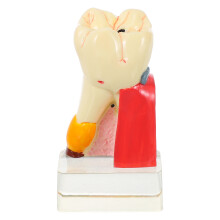 1Tandheelkundig Demonstratiemodel Resin Tool Voor Thuis