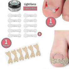 (16PCS E) 4-20pcs Nail Correction Stickers Paronychia Treatment Ingrown Toenail Correction Elastic Straightening Clip Brace Pedicure Tools