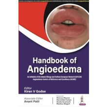 Handbook of Angioedema by Kiran V Godse Paperback Book