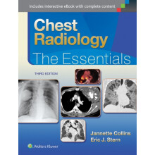 Chest Radiology The Essentials by Janette Collins Hardcover Book