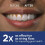 Waterpik Waterpik Ultra Professional Water Flosser, 5 Tips, Advanced Pressure Control Sys 3