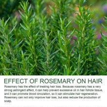 Youdaoplaceholder0 Rosemary Shampoo Prevent Hair Loss, Control Oil, Fluffy And Smooth Shampoo