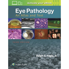 Eye Pathology An Atlas and Text by Ralph C. Eagle Hardcover Book
