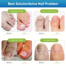 72pcs Toenail Repair Patches Repairing Damaged Nails Patches for Brittle Peeling Breaking Thin Nails