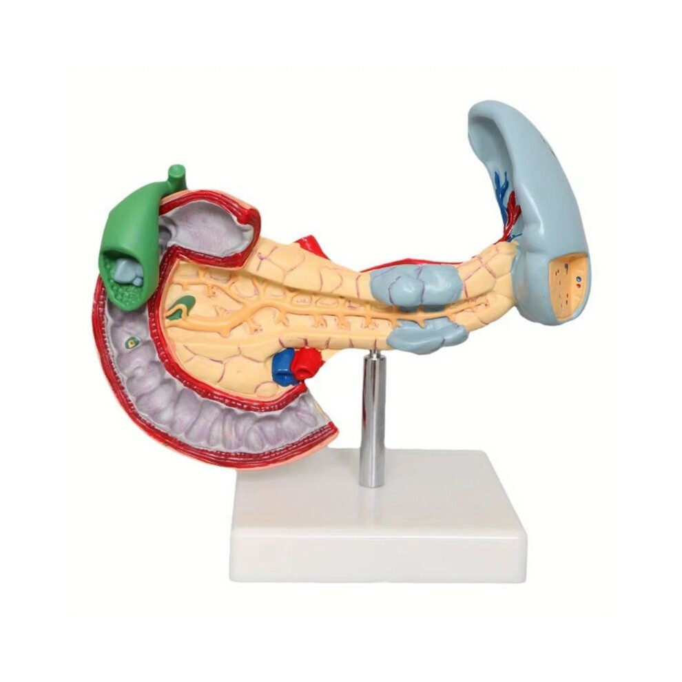 Zandonã New Medical Anatomy Life Size Anatomical Pancreas Model Human Pancreas Model Duodenum Spleen Pathological Learning