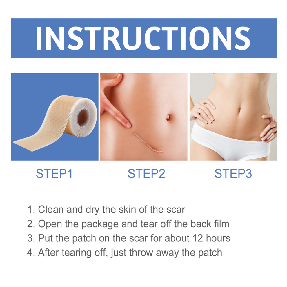 Creation-3C Silicone Scar Tape - Breathable & Flexible Recovery