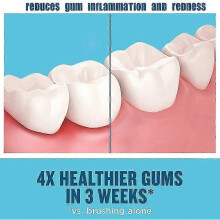 3 Bottles 30ml Teethaid Mouthwash Calculus Removal Teeth Whitening Healing Mouth Ulcers Eliminating Bad Breath Preventing And Healing Caries Tooth