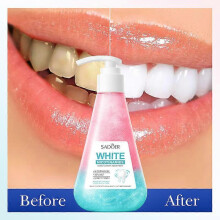 (3pcs) niacinamide toothpaste,niacinamide whitening toothpaste,fresh breath toothpaste, effective removal of breath