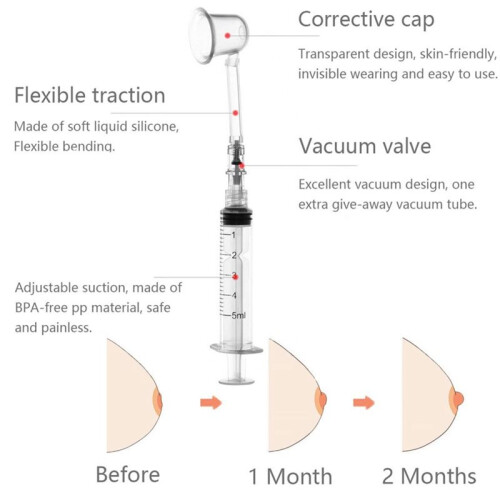 Inverted Nipple Corrector, Flat Nipple Suckers Aspirator Corrector 1