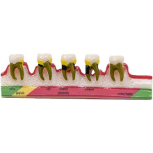 Dental Demonstration Model for Tooth and Periodontal