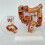 Human Large Intestine Anatomical Model Colon Pathology 1pc 6