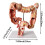 Human Large Intestine Anatomical Model Colon Pathology 1pc 3
