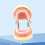 Soft Removable Tooth Model for Dental Veneer Preparation 2
