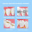 Interdental Brush Soft Oral Cleaning Tool 50 Pieces 4
