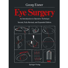 Eye Surgery An Introduction to Operative Technique Paperback Book