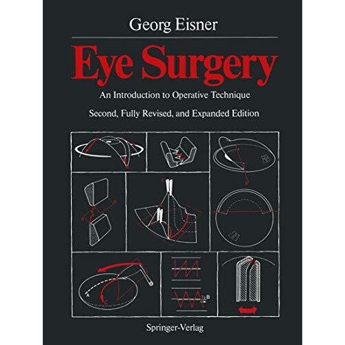Eye Surgery An Introduction to Operative Technique Paperback Book