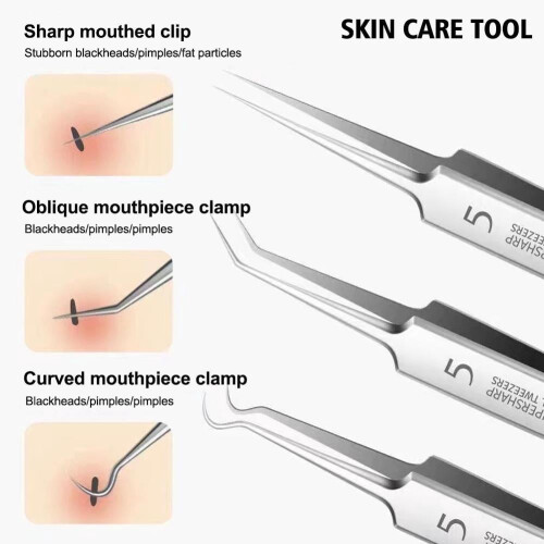 Blackhead Remover Tool for Acne and Comedones 2