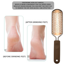 Pedicure Foot File Callus Remover Large Foot Rasp Colossal Foot Scrubber Foot Tools Professional Nursing Health