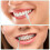 Soft Silicone Interdental Brushes for Braces 150 pcs 7