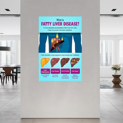 Fatty Liver Disease Chart Poster Canvas Wall Decor 1