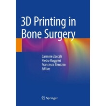 3D Printing in Bone Surgery Paperback Book