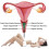 Σετ άσκησης Jade Egg για γυναίκες, πράσινο Kegel Trainer 3 τεμαχίων για την εκγύμναση τ 2