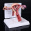 Pathological Uterus and Ovary Model with Base and 1