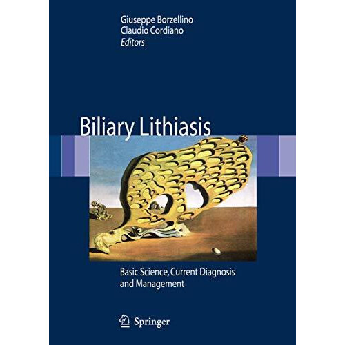 Biliary Lithiasis Basic Science Current Diagnosis and Management Paper