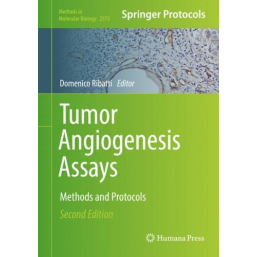 Tumor Angiogenesis Assays Methods and Protocols Hardcover Book
