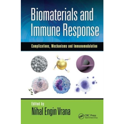 Biomaterials and Immune Response Complications Mechanisms and Immunomo