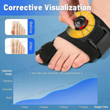 (1 Pair) Toe Separator Bunion Corrector Orthopedic Hallux Valgus Adjuster Foot Care