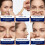 Massner Nasal Strips Medium 100 Pack  Extra Strength Anti Snoring Nose 2