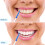 Silicone Double-Sided Interdental Brushes 80 Pieces 6