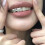 Ασημένια καλύμματα δοντιών Pentagram Star Grillz για άνδρες και γυναίκες 3