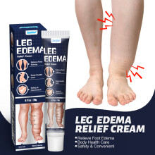 Natural Edema Elimination Cream Remove Arm Leg Swelling Pain Relief 20g