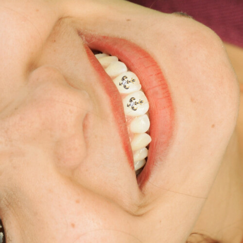 Retro dental drill tooth jewels 3 pcs 1