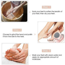 Portable Electric Vacuum Foot Grinder: Usb Rechargeable Dead Skin Care Tool (pink)