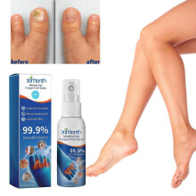 Effective Foot Spray for Nail Fungus, Moisturizing, Anti-Itch, Fast Relief ,30ml