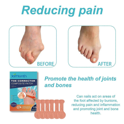 Relieve Bunion Pain, Improve Toe Malformations, Foot Care Corrector Patch ,10patches