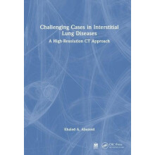 Challenging Cases in Interstitial Lung Diseases A HighResolution CT Ap