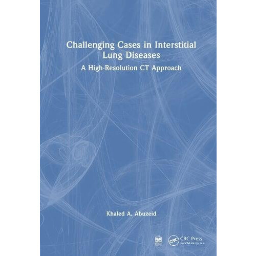 Challenging Cases in Interstitial Lung Diseases A HighResolution CT Ap