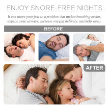 (3PCS) Anti Snore Mouthpiece, Sleep At Night Anti-snoring Molar Teeth Guard Protective Braces