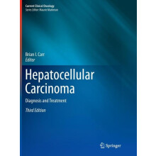 Hepatocellular Carcinoma Diagnosis and Treatment Paperback Book